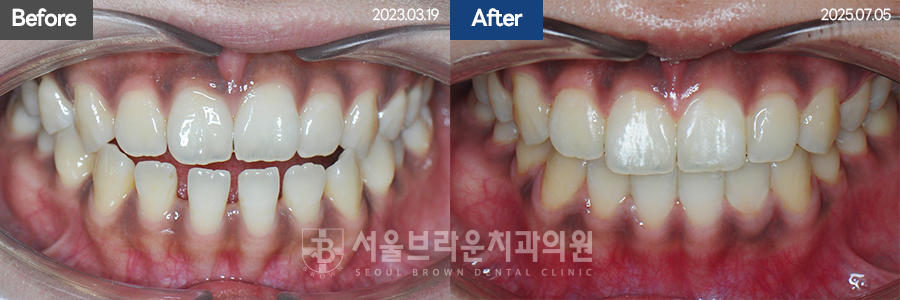 94cf162dcaf9d360a836348299e54f18_1776762