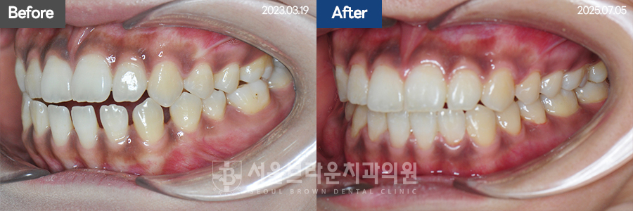 94cf162dcaf9d360a836348299e54f18_1776762