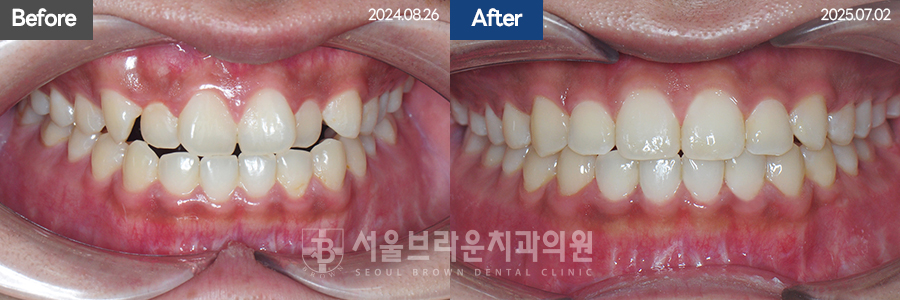 bcfceb9352709ab5a754937c119cf84a_1775027