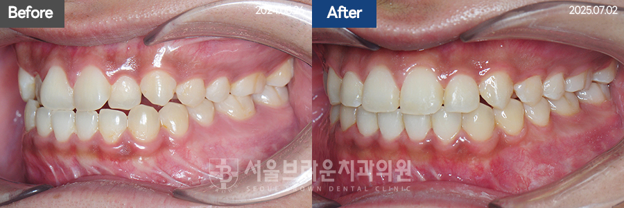 bcfceb9352709ab5a754937c119cf84a_1775027