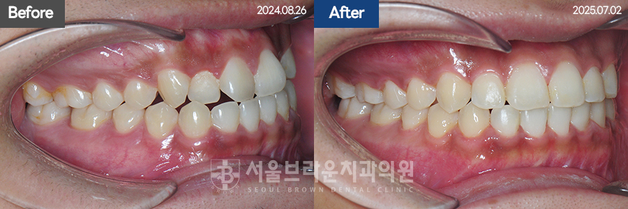 bcfceb9352709ab5a754937c119cf84a_1775027