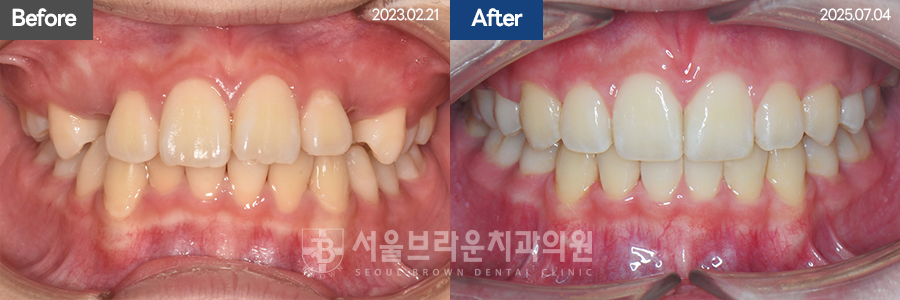 bcfceb9352709ab5a754937c119cf84a_1775028