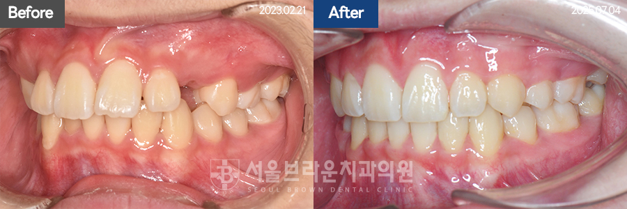 bcfceb9352709ab5a754937c119cf84a_1775028