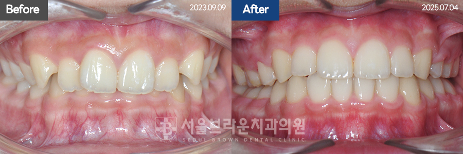 bcfceb9352709ab5a754937c119cf84a_1775028