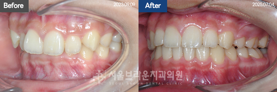 bcfceb9352709ab5a754937c119cf84a_1775028