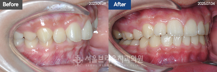 bcfceb9352709ab5a754937c119cf84a_1775028