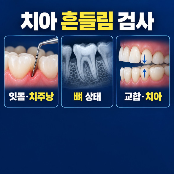 흔들리는 치아의 잇몸 치주낭 잇몸뼈 교합과 치아 상태 검사 항목