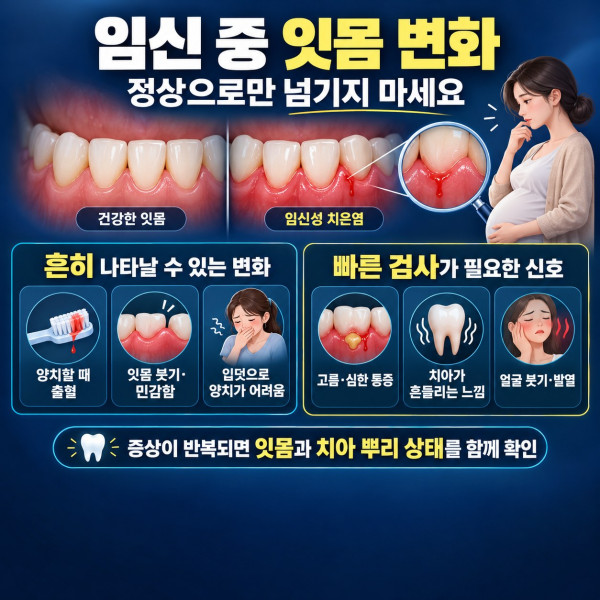 임신성 치은염의 잇몸 붓기 출혈 통증과 빠른 치과 검사가 필요한 증상 안내