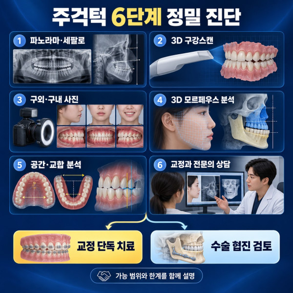 대전 주걱턱 교정 6단계 정밀 진단과 교정 단독 치료 수술 협진 판단 과정