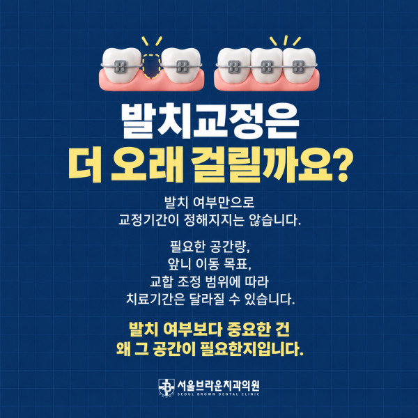 대전 치아교정에서 발치 여부와 필요한 공간량 앞니 이동 교합 조정에 따라 치료기간이 달라지는 이유