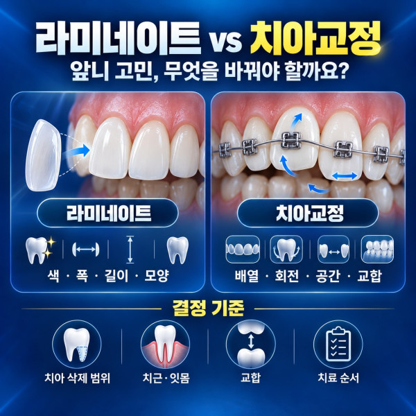 대전 라미네이트 교정 비교에서 앞니 모양과 색 배열 회전 공간 교합의 차이를 설명하는 안내