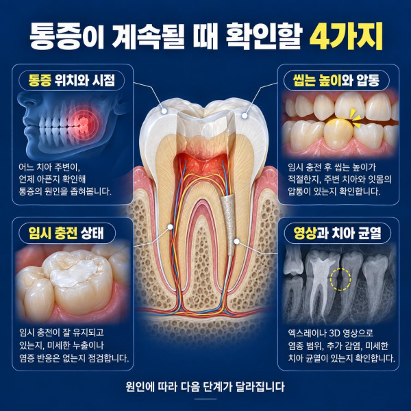 신경치료 중 통증이 계속될 때 위치와 시점 씹는 높이 임시 충전 상태 영상 및 균열 확인 항목