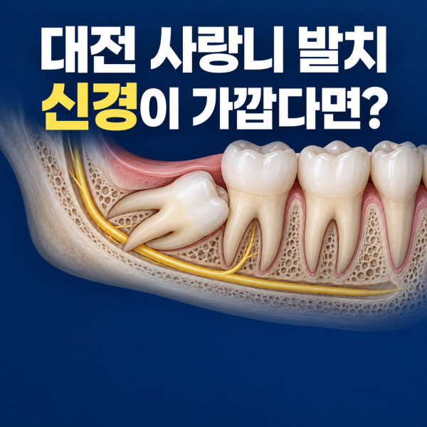 대전 사랑니 발치 전 신경과 가까운 매복사랑니 상담 안내