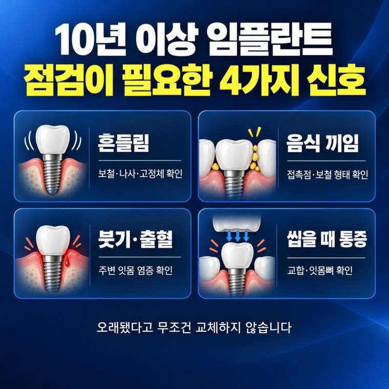 대전 임플란트 점검이 필요한 10년 이상 임플란트의 흔들림 음식 끼임 출혈 신호