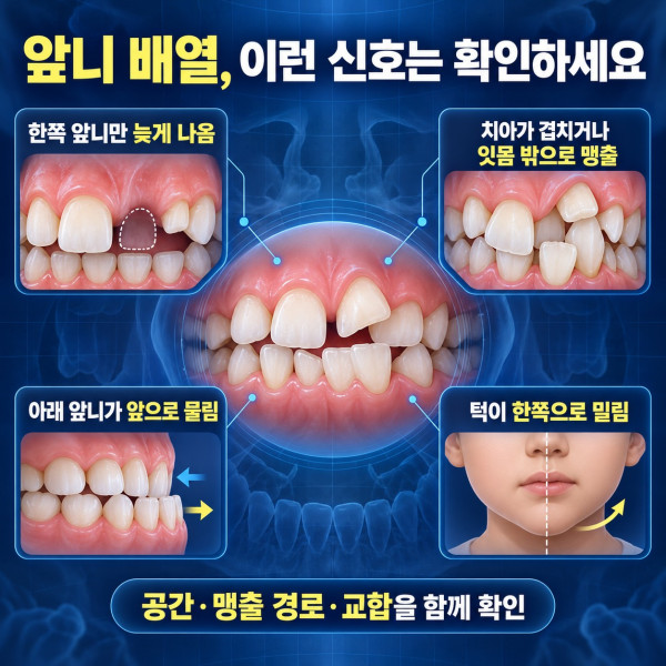 아이 앞니가 삐뚤게 날 때 공간 부족 반대교합 맹출 지연과 턱 이동을 확인하는 신호