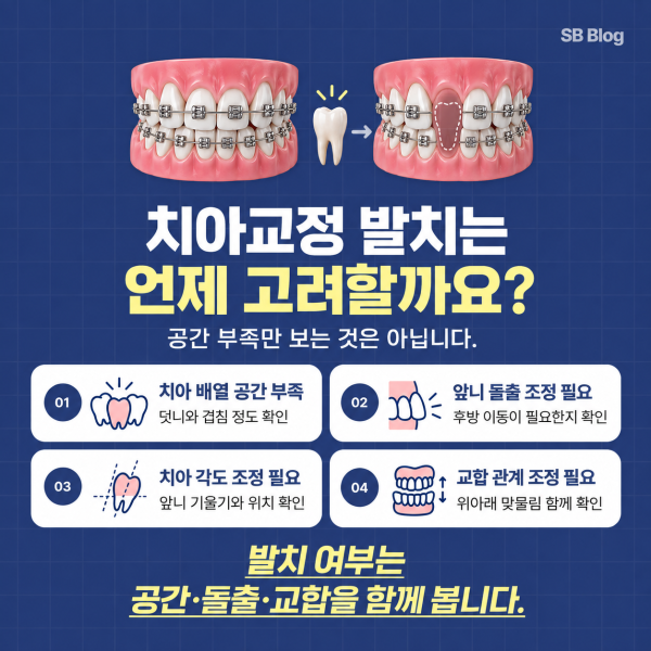 치아 배열 공간 부족과 돌출 치아 각도 교합을 확인하는 교정 발치 기준
