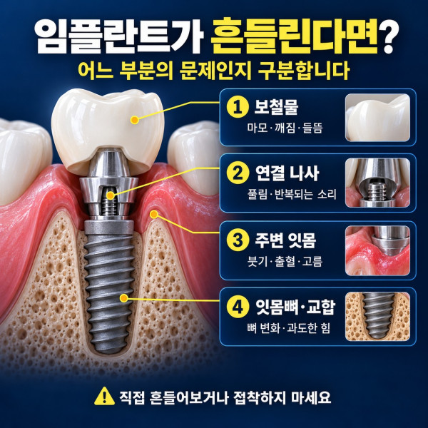 임플란트 흔들림 원인을 보철물 연결 나사 주변 잇몸과 잇몸뼈로 나눈 점검표