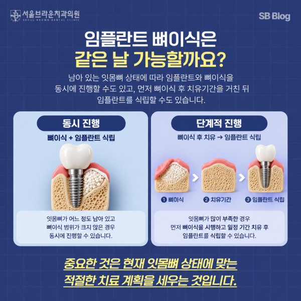 임플란트 뼈이식과 임플란트 동시 식립 및 단계적 치료 비교