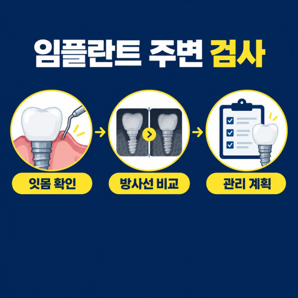 임플란트 주변 잇몸 확인 방사선 비교와 개인별 관리 계획 검사 과정