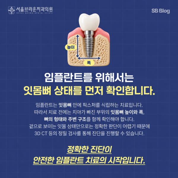 대전 임플란트 진단에서 잇몸뼈 높이와 폭을 확인하는 모습