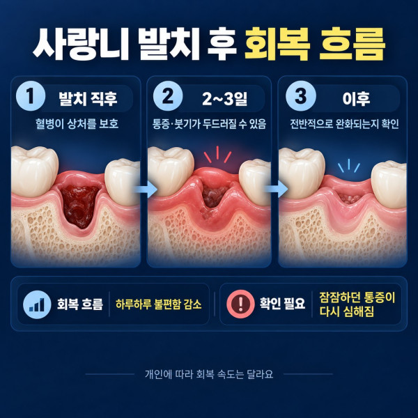 사랑니 발치 직후 혈병 형성부터 2~3일 통증 붓기와 이후 완화 여부를 확인하는 회복 흐름
