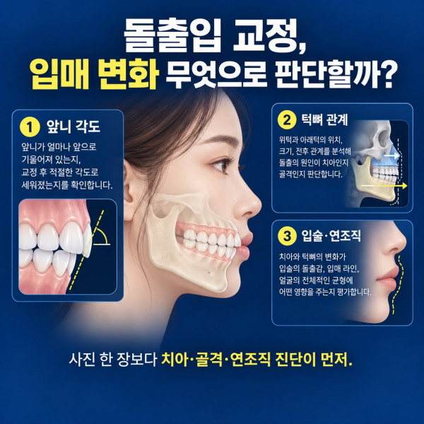 대전 돌출입 교정 상담 전 앞니 각도 턱뼈 관계 입술 연조직을 함께 확인하는 진단 안내