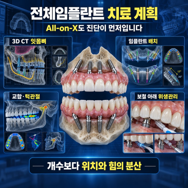 전체임플란트 All-on-X 치료 전 3D CT 교합 임플란트 배치와 관리 기준