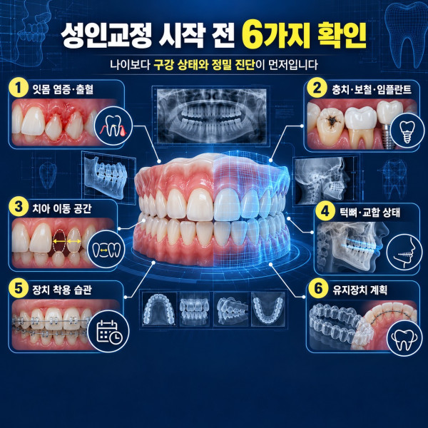 성인교정 시작 전 잇몸 염증 충치 보철 임플란트 이동 공간 교합과 유지장치 확인사항