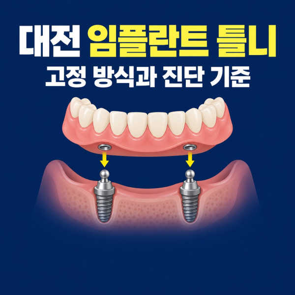 대전 임플란트 틀니의 고정 방식과 개인별 정밀진단 기준 안내