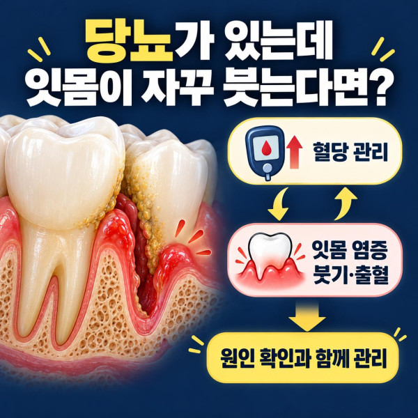 당뇨 환자의 잇몸 붓기와 출혈을 보여주며 혈당 관리와 잇몸 염증을 함께 확인하는 안내