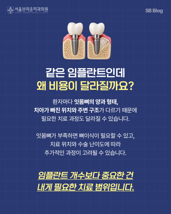 대전 임플란트 비용에 영향을 주는 잇몸뼈 상태와 뼈이식