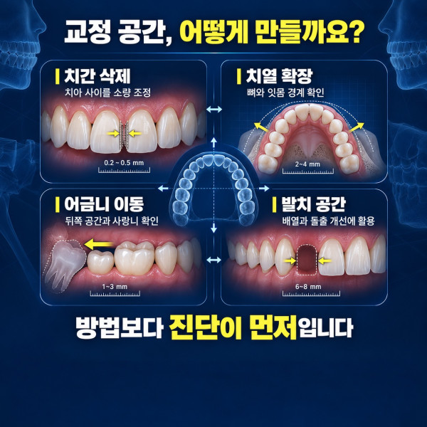 교정 공간 부족을 발치 치간삭제 치열 확장 어금니 이동으로 해결하는 방법 비교