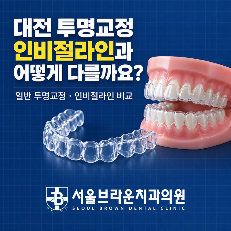 대전 투명교정과 인비절라인 차이 및 치료 전 확인사항 안내