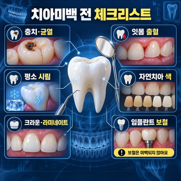 치아미백 전 충치 잇몸 시림 자연치아와 크라운 라미네이트 임플란트 보철 확인사항