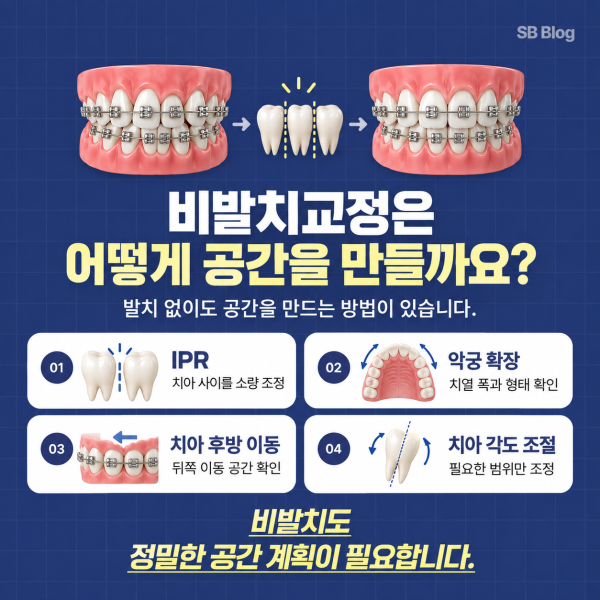 비발치교정에서 IPR 악궁 확장 치아 후방 이동과 각도 조절로 공간을 확보하는 방법