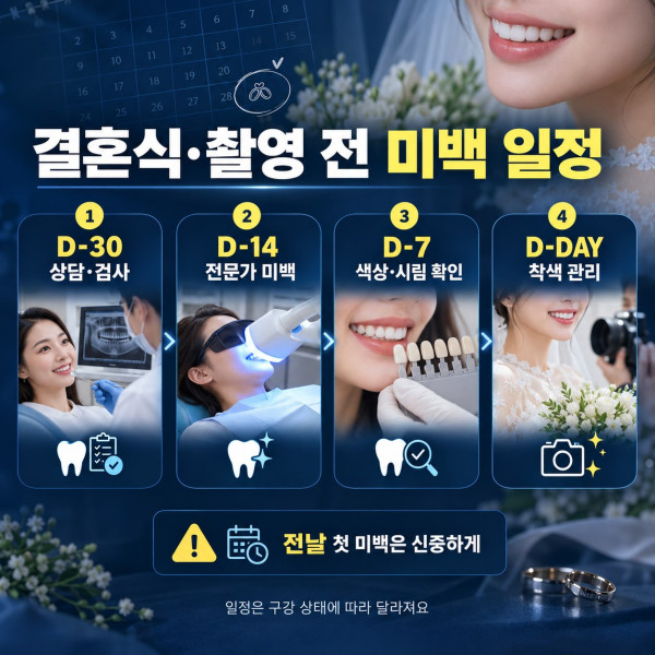 결혼식과 프로필 촬영 전 치아미백 상담 치료 색상 확인과 착색 관리 일정표