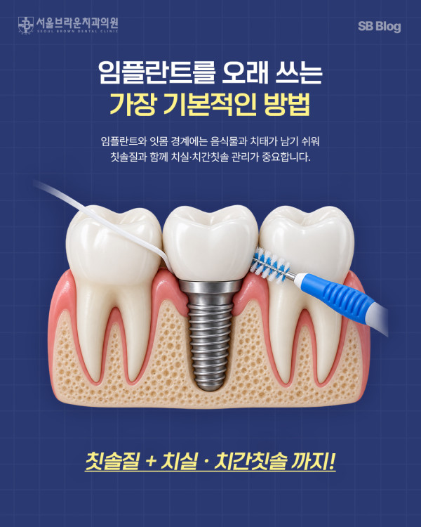 임플란트 치실과 치간칫솔 관리 방법