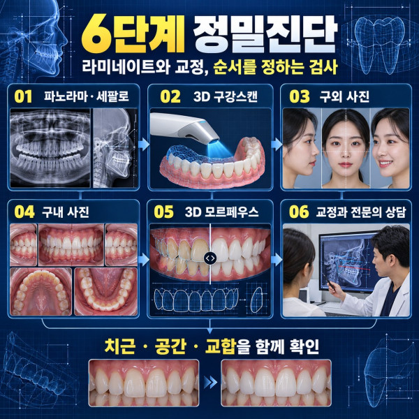 라미네이트와 치아교정 치료 순서를 정하기 위한 파노라마 세팔로 3D 구강스캔 사진 분석과 전문의 상담 6단계 진단