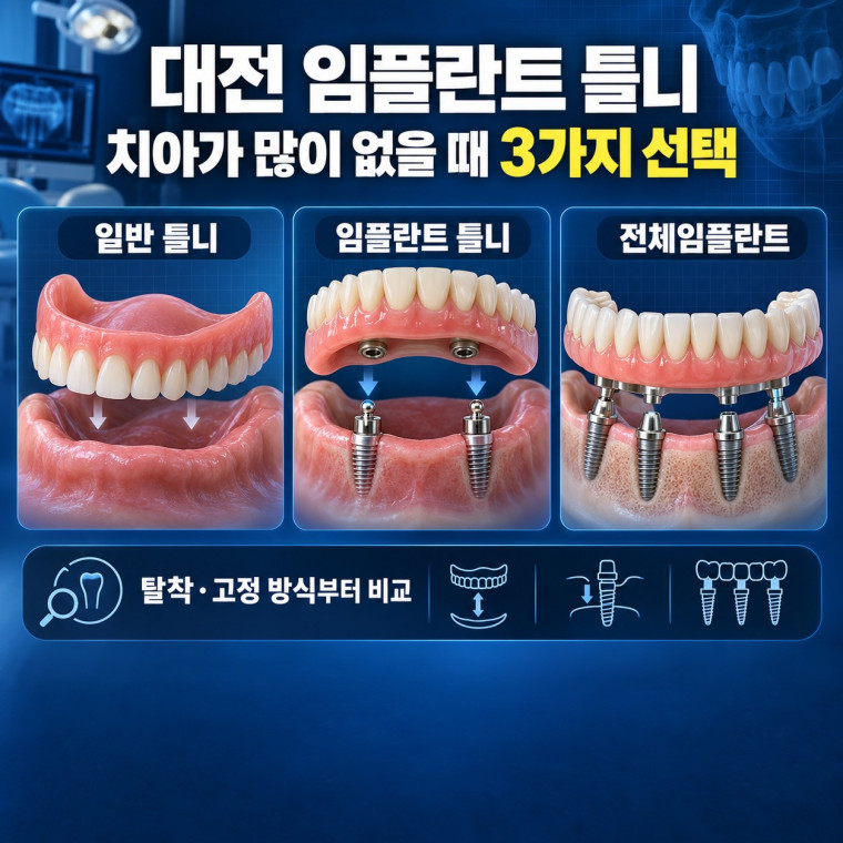 대전 임플란트 틀니 상담에서 일반 틀니 임플란트 틀니 전체임플란트 비교 안내