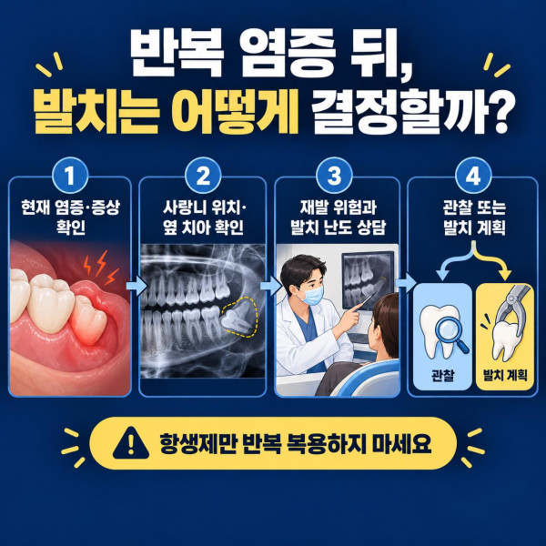 반복되는 사랑니 잇몸 염증에서 현재 증상 사랑니 위치 재발 위험을 확인해 관찰 또는 발치를 계획하는 과정