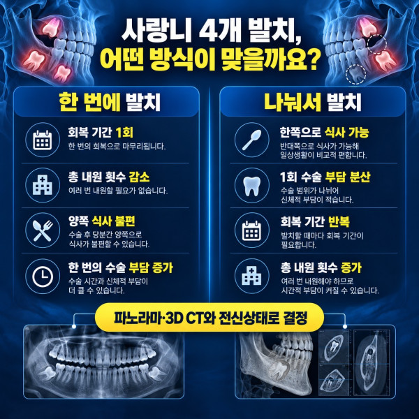 사랑니 네 개를 한 번에 발치하는 방법과 나누어 발치하는 방법의 회복 식사 수술 부담 비교