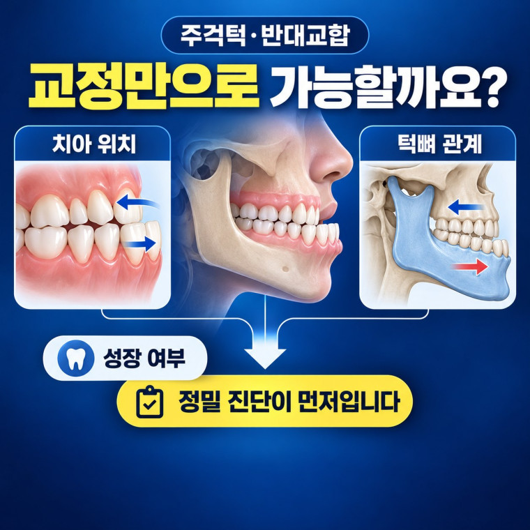 대전 주걱턱 교정 상담 전 치성 반대교합과 골격성 주걱턱을 구분하는 진단 안내