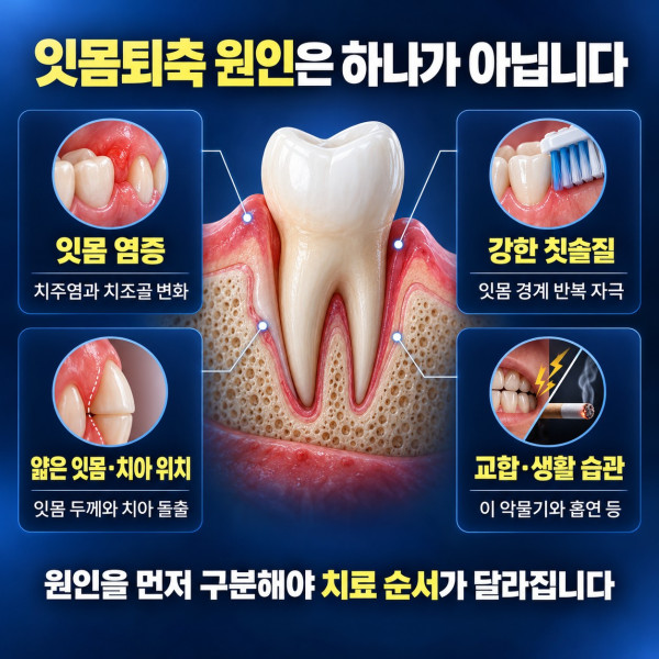 잇몸퇴축 원인을 잇몸 염증 강한 칫솔질 얇은 잇몸 치아 위치와 생활습관으로 나눈 체크리스트