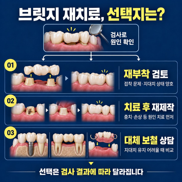 브릿지 재치료 시 검사 결과에 따른 재부착 치료 후 재제작 대체 보철 상담 선택지