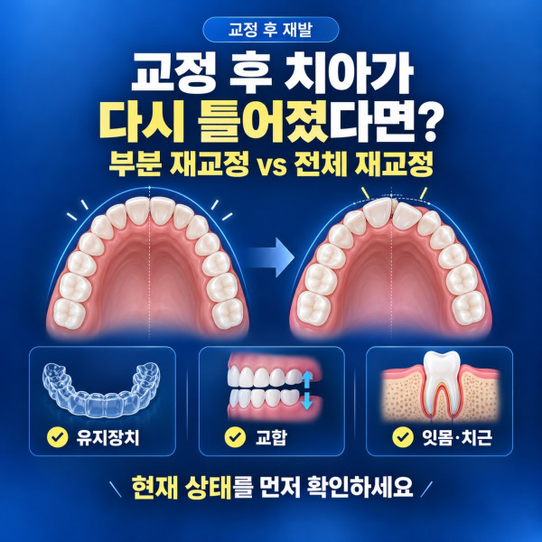 교정 후 치아가 다시 틀어졌을 때 대전 재교정 전 유지장치와 교합을 확인하는 안내