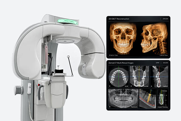 3D CT 촬영