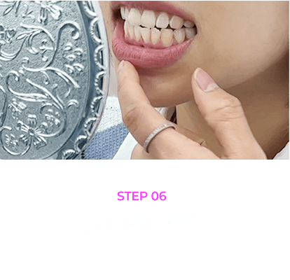 대전치아미백 과정: 6.치아색상 확인